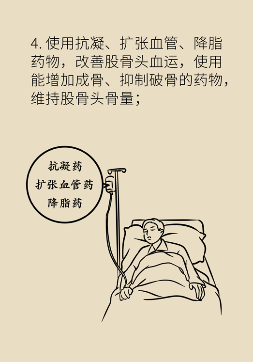 激素會(huì)帶來(lái)股骨頭壞死的后遺癥嗎？