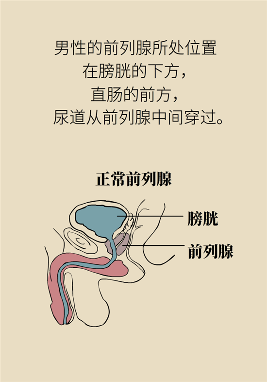 前列腺肥大了還能縮小嗎？