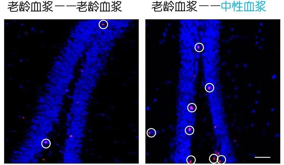 重返年輕不用大換血，只要給血液“兌點(diǎn)水”？