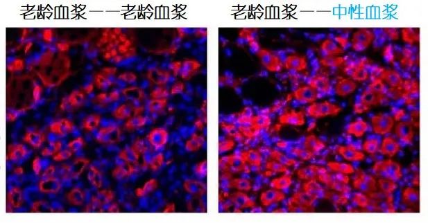 重返年輕不用大換血，只要給血液“兌點(diǎn)水”？