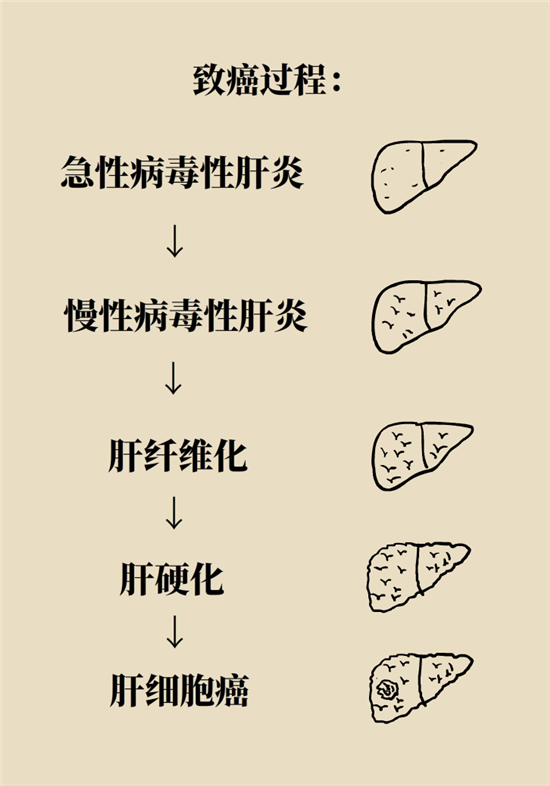 癌癥會(huì)傳染嗎？專家：這些高危因素得注意