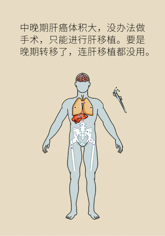 論發(fā)現(xiàn)早期肝癌的本事，cfDNA比AFP更精準(zhǔn)，比影像學(xué)更早一步