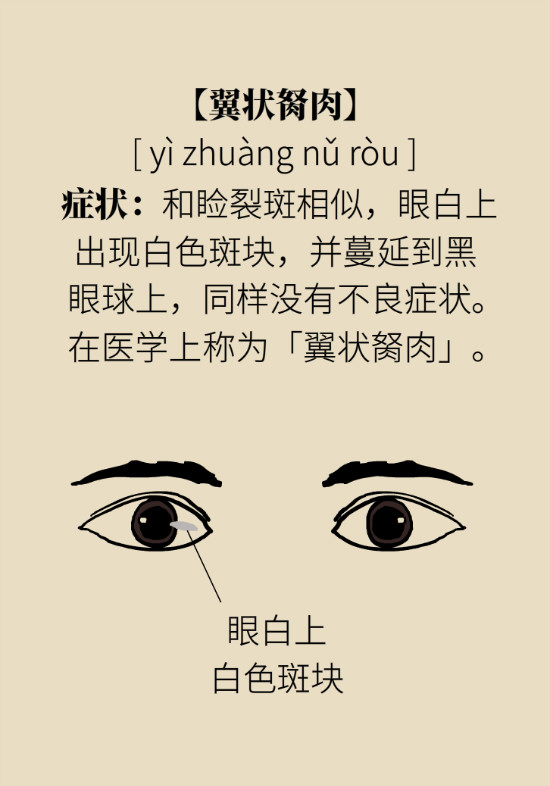 眼白有斑塊、出血要緊嗎？專家：名字唬人但問題不大