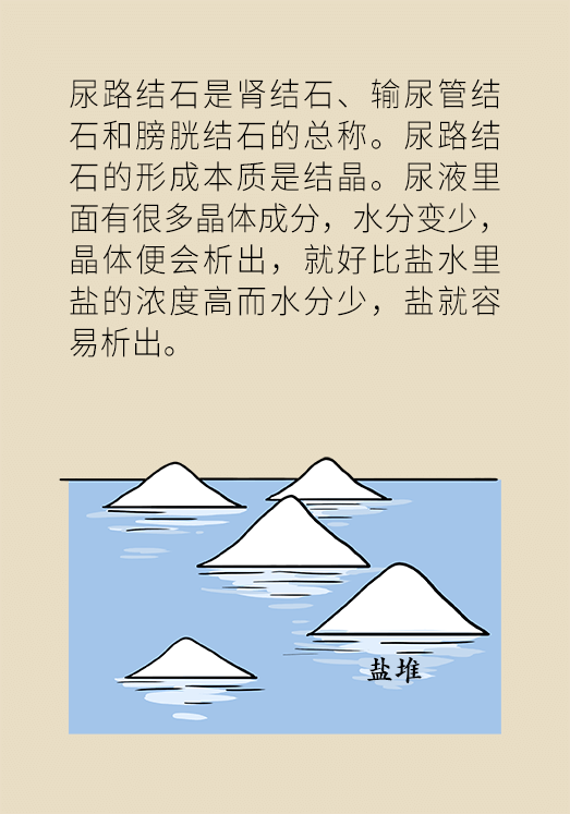 尿結(jié)石科普動漫